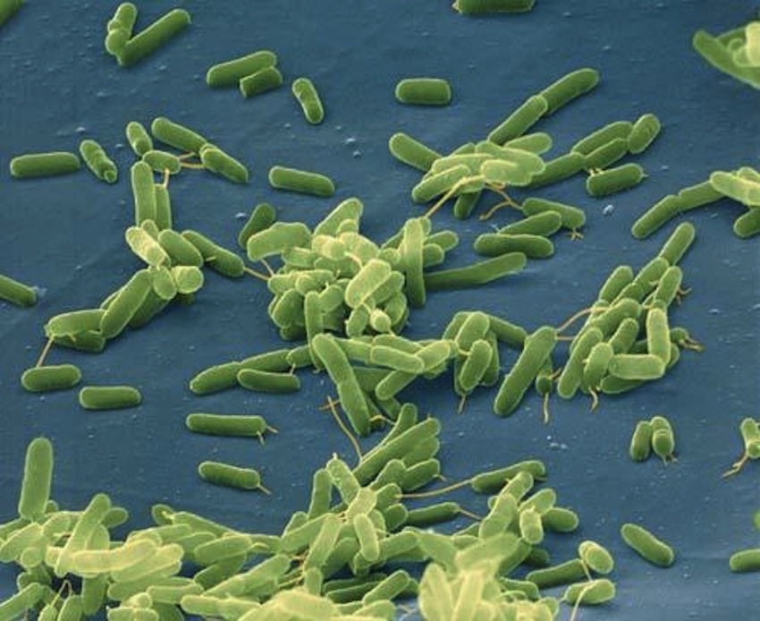 人食いバクテリアは身近にいる。日本の海にもいるかも・・・